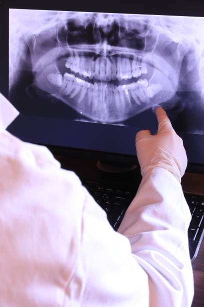 Best Emergency Tooth Extraction in Irving, TX