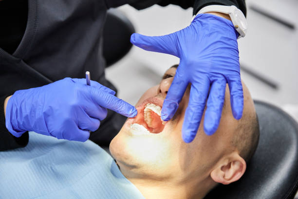 Best Emergency Denture Repair in Irving, TX